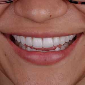 Paciente transformado 3